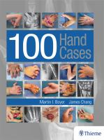 100_hand_cases