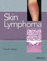 Skin_lymphoma
