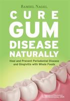 Cure_gum_disease_naturally