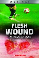 Flesh_wound