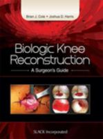 Biologic_knee_reconstruction