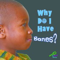 Why_do_I_have_bones_
