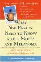 What_you_really_need_to_know_about_moles_and_melanoma